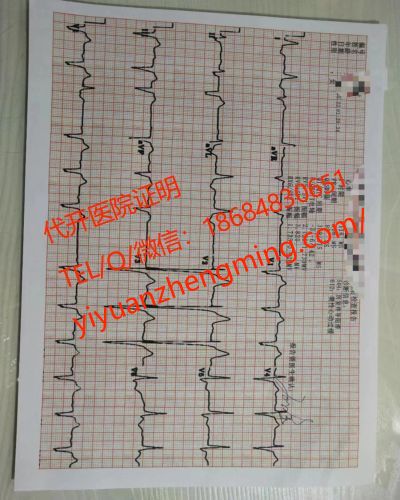 代开医院体检报告